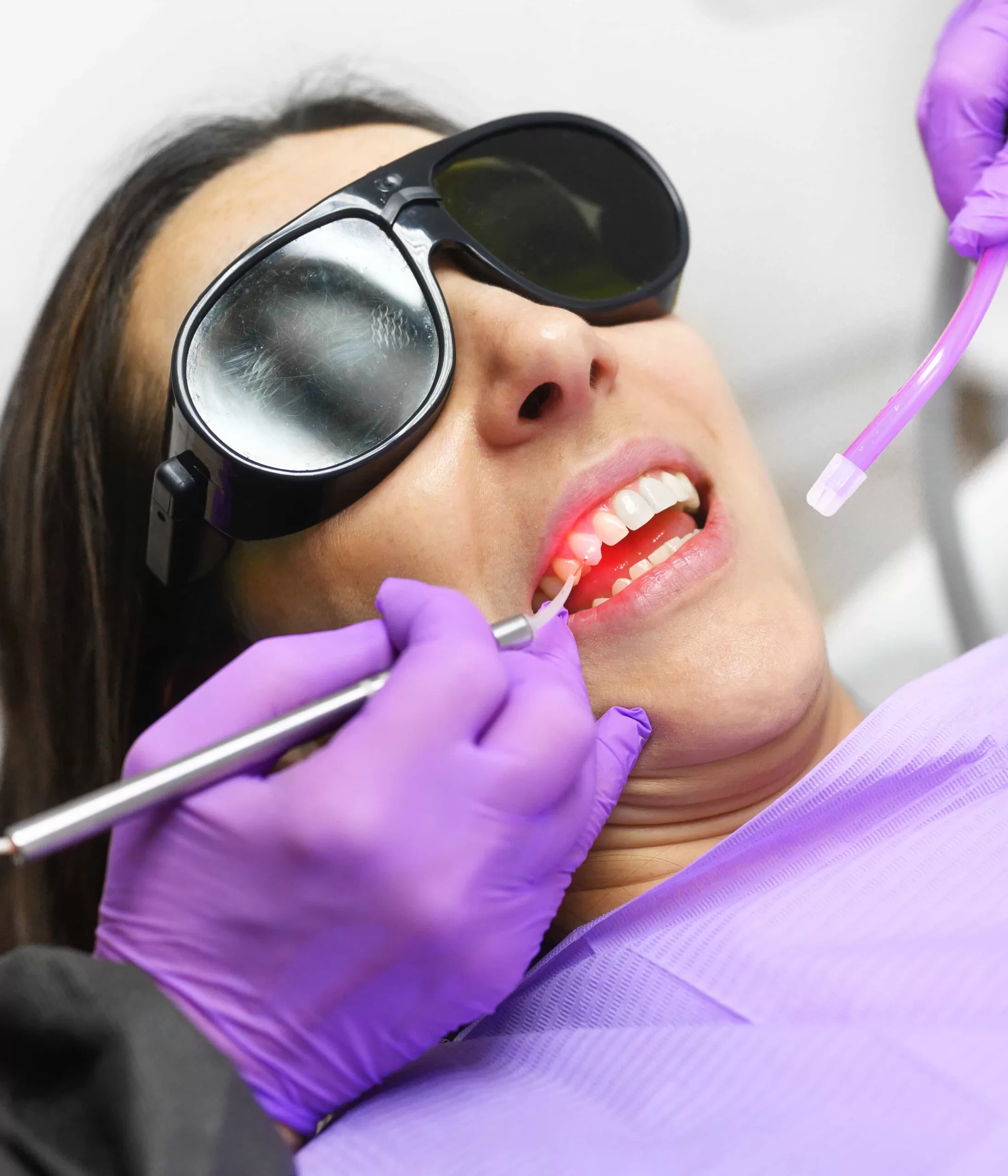 Dental Laser therapy, Smile Architects dental clinic